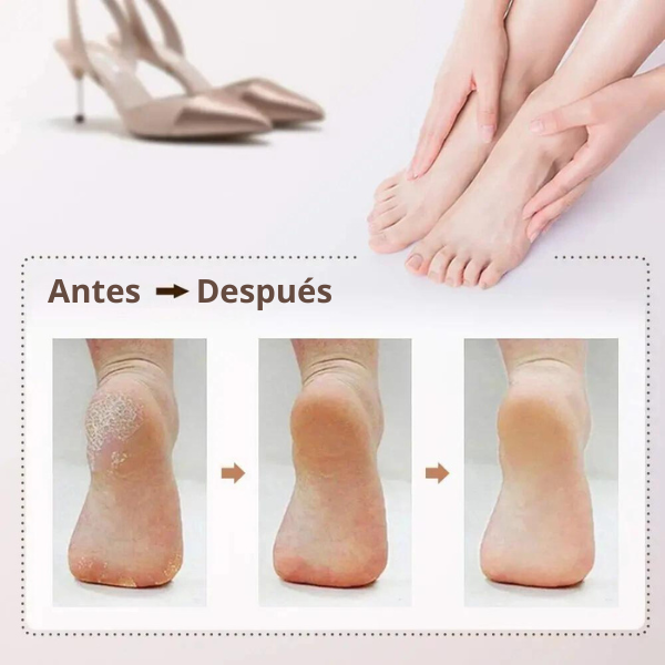 PediFoot PRO® Lima Recargable Para Pies y Manos