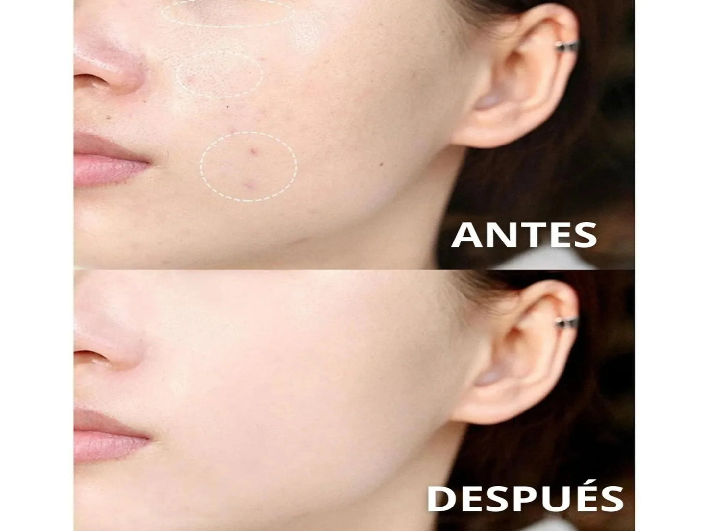 MASCARILLA BLANQUEADORA